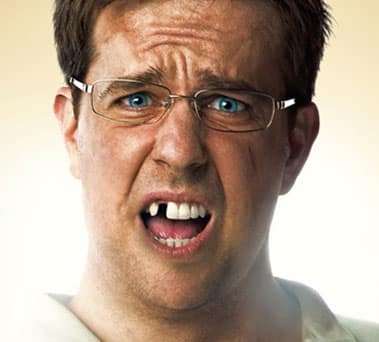 Hangover actor Ed Helmes missing tooth dental implant