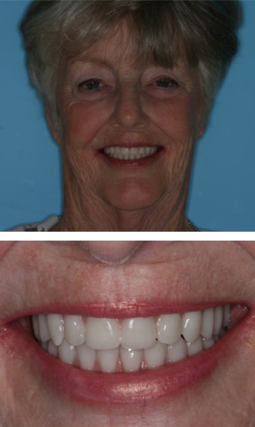 Carol-T-After