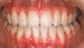 ortho_01_after