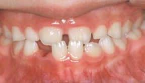 ortho_04_before